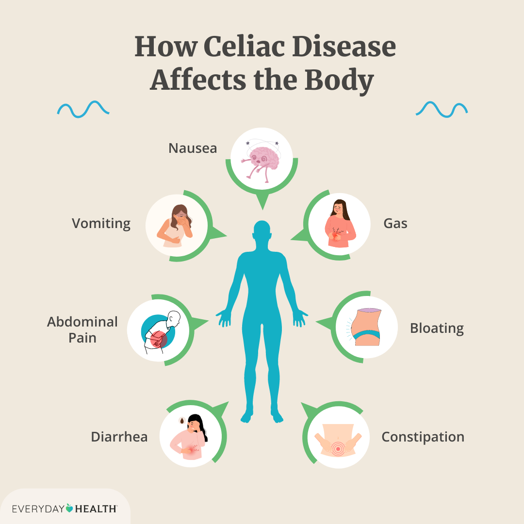 Celic: Symptoms, diagnosis, and easy treatment.