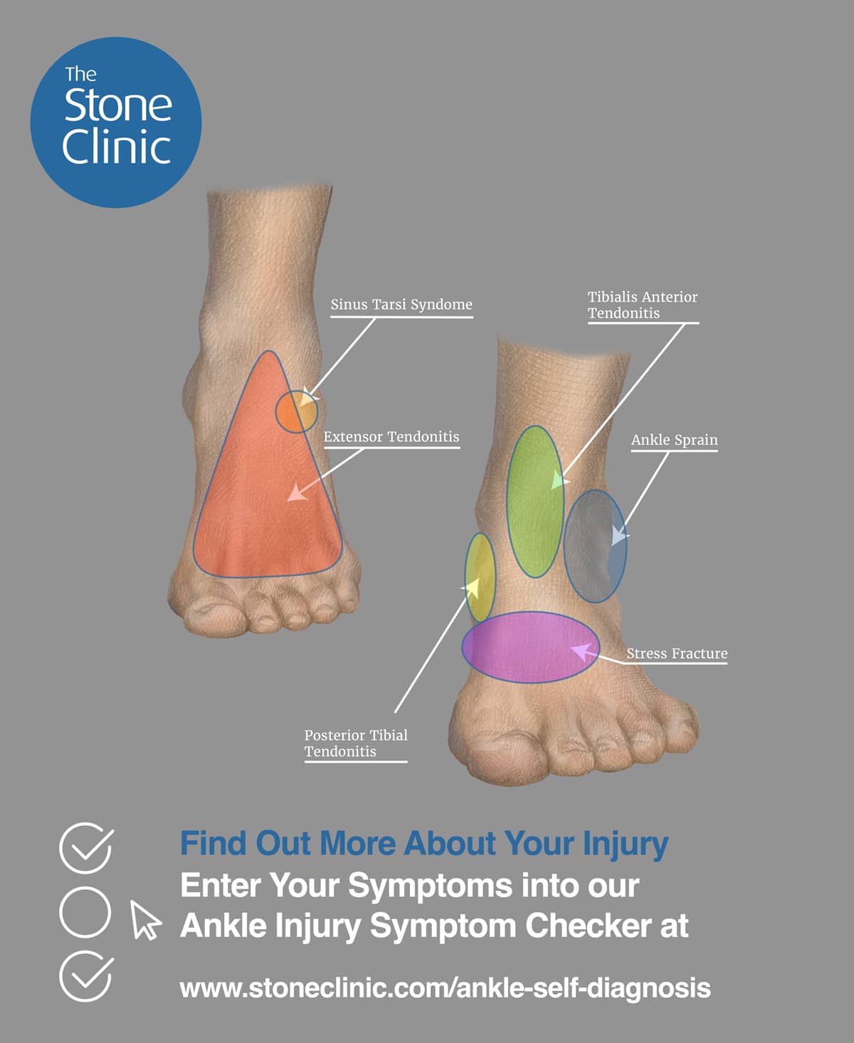 Ankle Injuries Pictures: A Visual Guide to Common Ankle Problems and Their Symptoms.