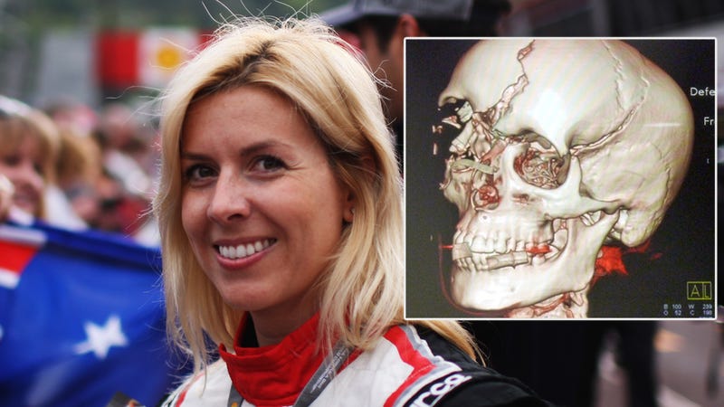 Maria de Villota Accidente: How Did it Happen? (Heres a Look at the Crash Details and Aftermath)