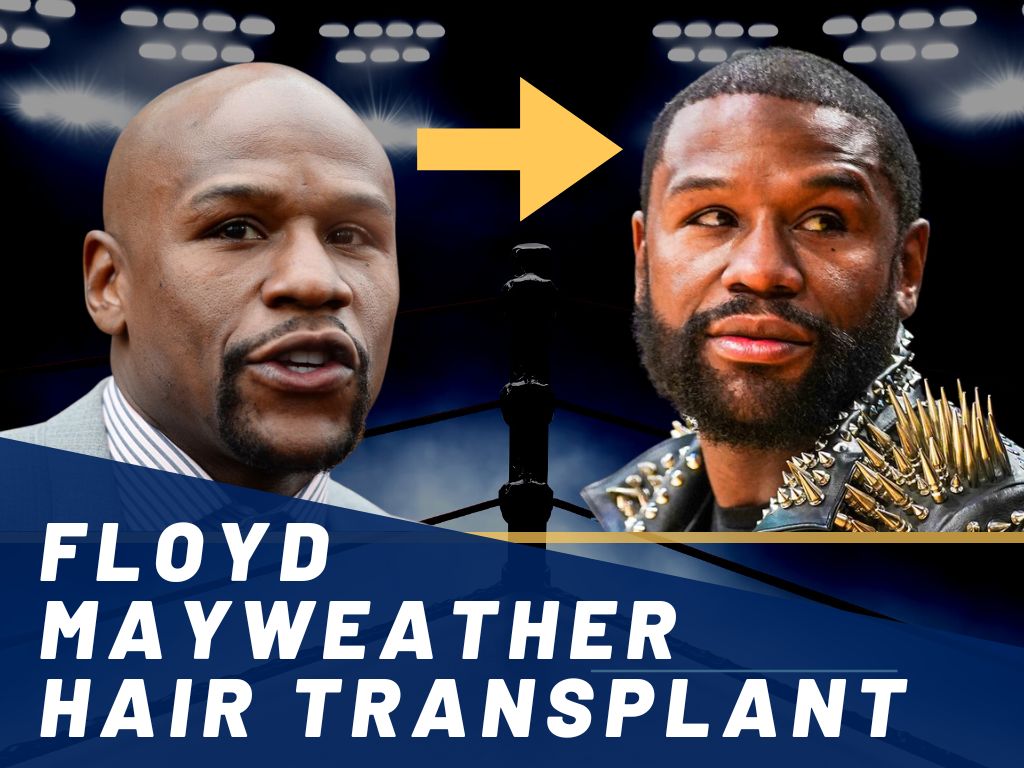 Is This Real? Floyd Mayweather with Hair Shocks the Boxing World!