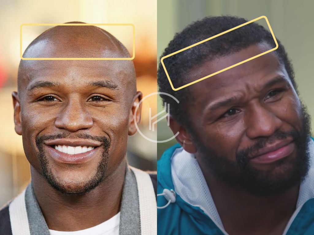 Is This Real? Floyd Mayweather with Hair Shocks the Boxing World!