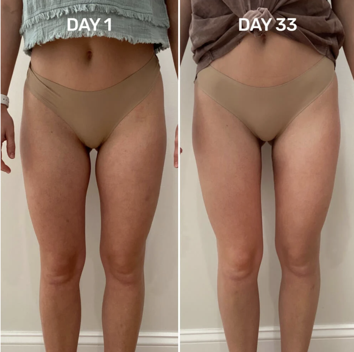 Maelys B Tight Review: Does This Anti-Cellulite Cream Really Work?