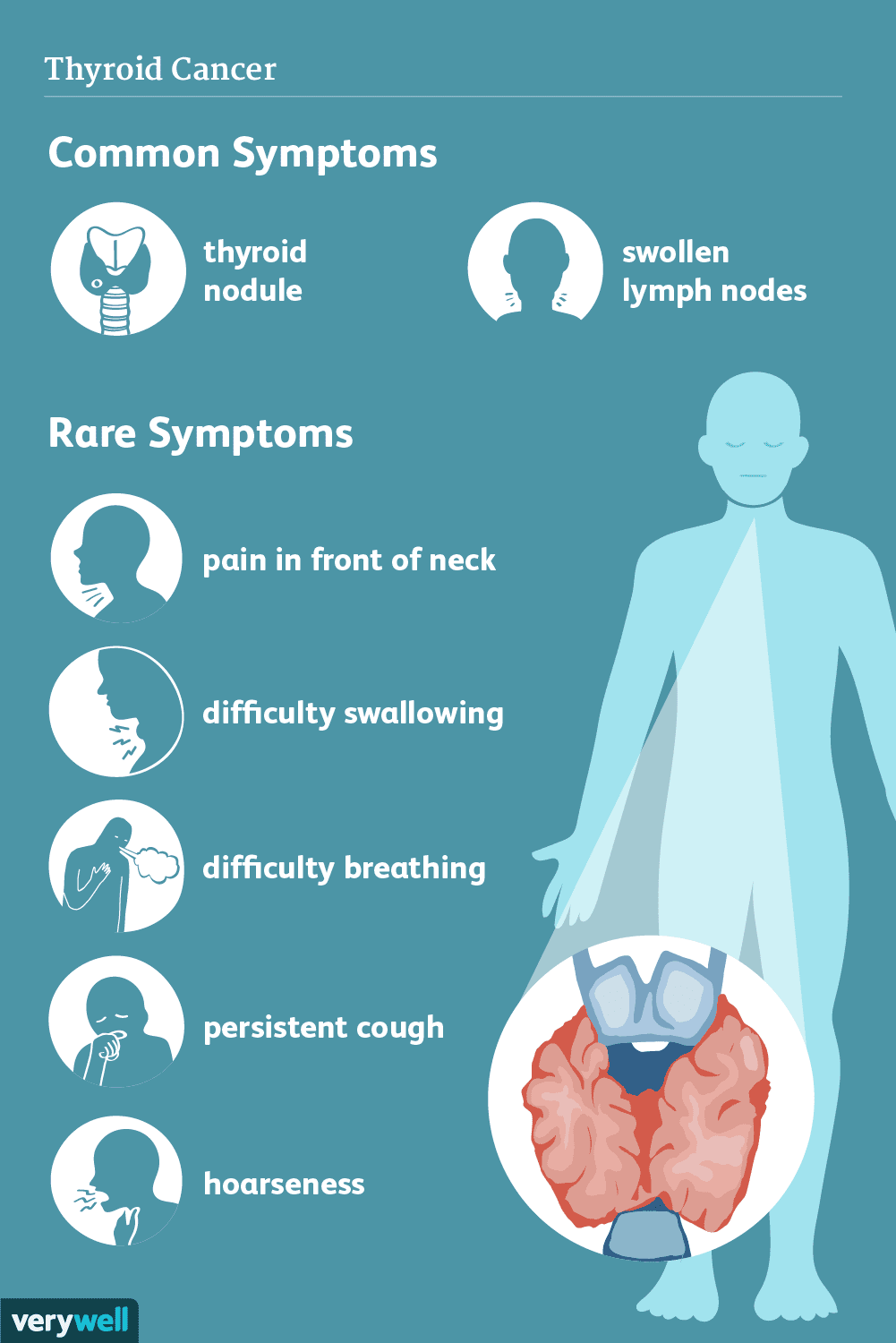 Thyroid Notch Pain: Common Causes (When to See a Doctor)