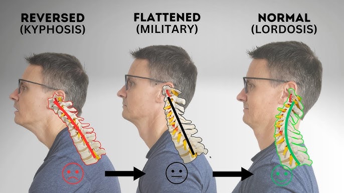 Fix natua natua Common Issues? Easy Solutions Step by Step!