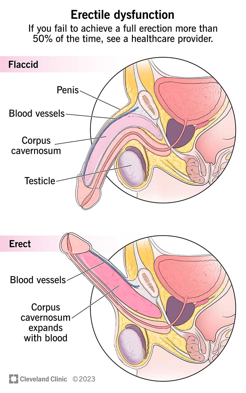 The penis eek problem? Learn top advice to address it fast.