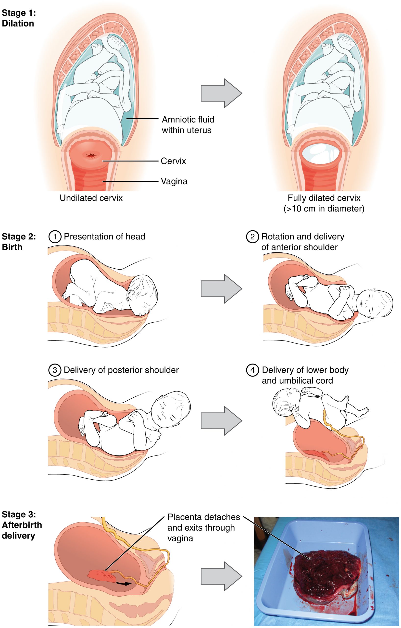 Imminent Childbirth Signs: What Happens When Baby Comes Soon (How Mothers Prepare For Labor Now)